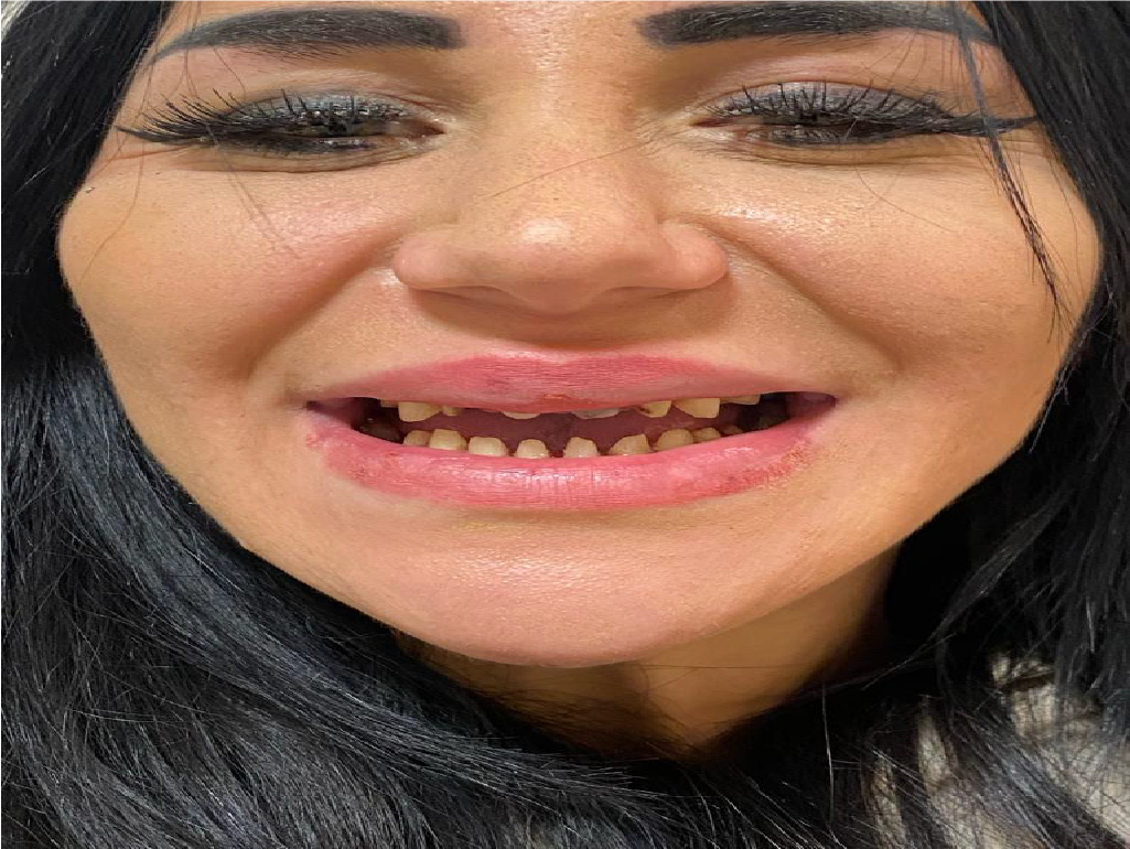 dd